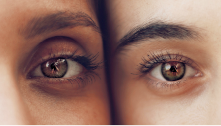 Dark Under Eye Circles: How They Form And How To Treat Them – Zove Beauty